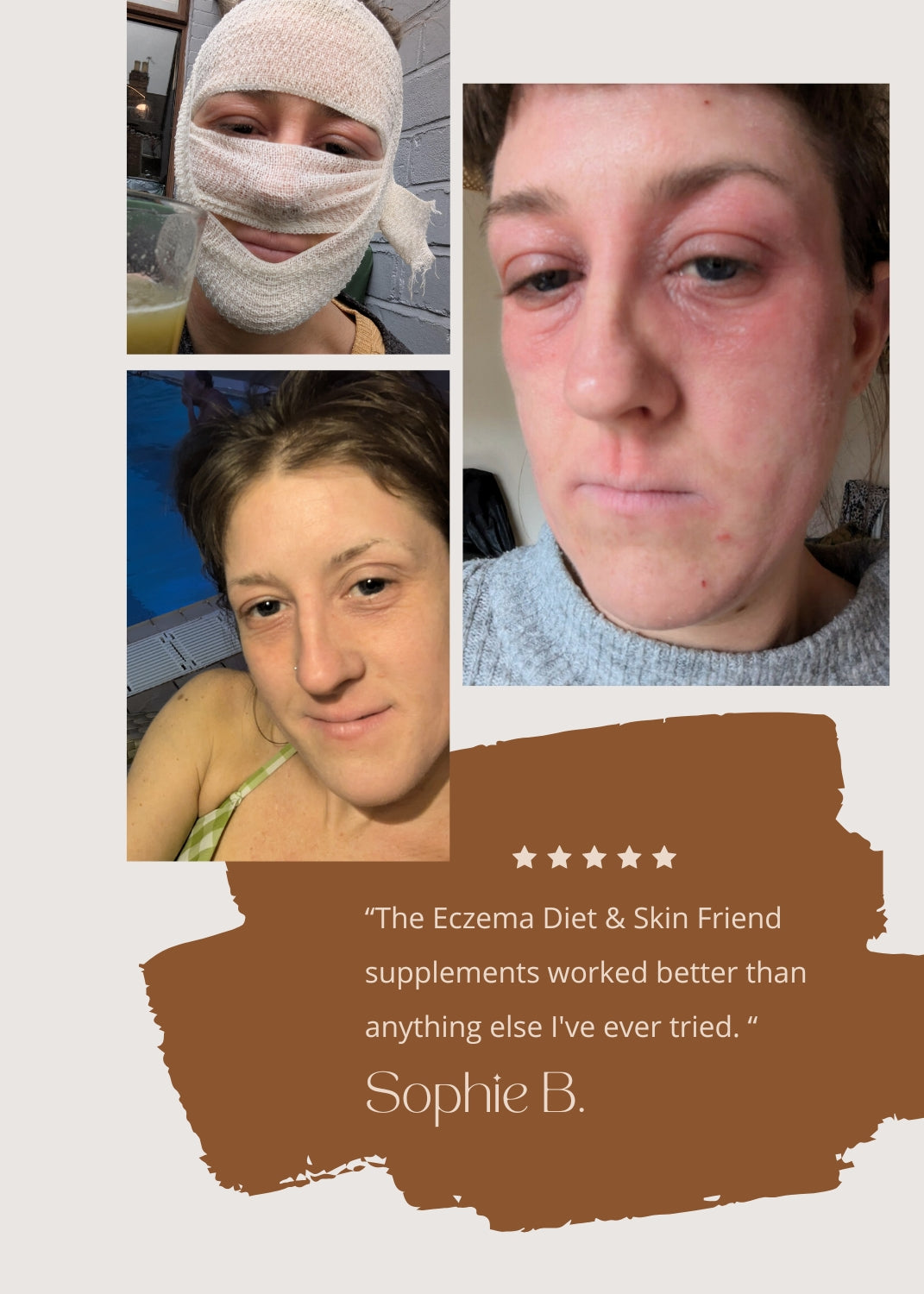 Skin Friend Original Bundle